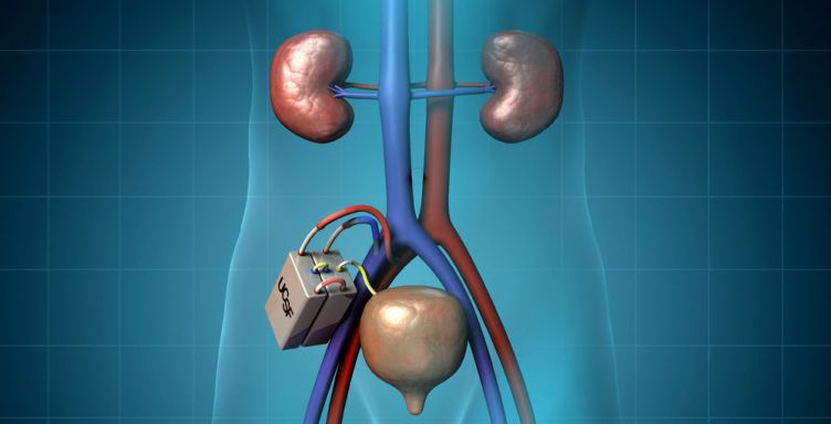 Converging Technologies and Stem Cells: Towards a Bioartificial Kidney