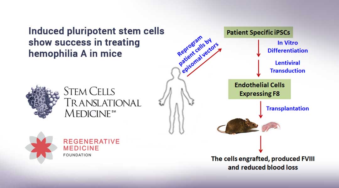 Induced pluripotent stem cells show success in treating hemophilia A in mice
