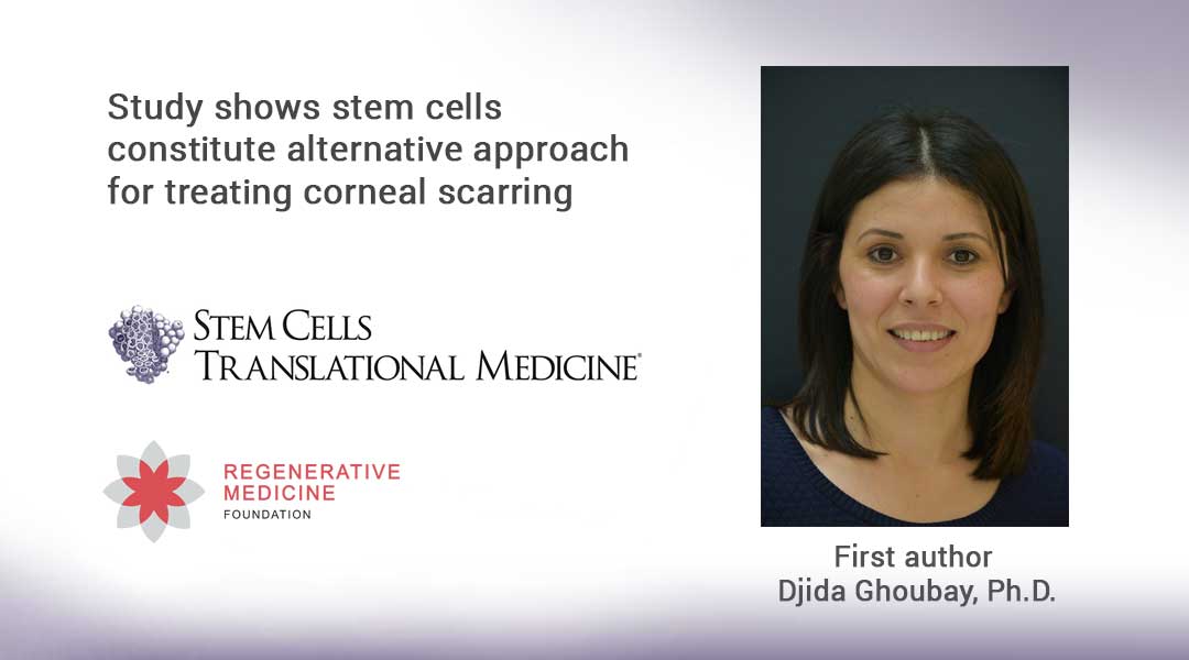 Study shows stem cells constitute alternative approach for treating corneal scarring