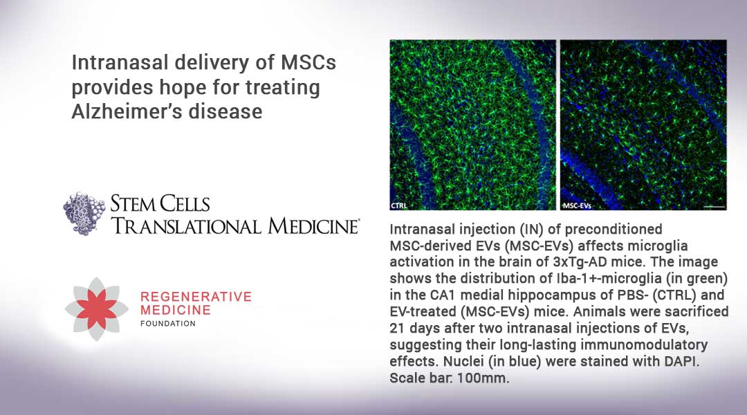Intranasal delivery of MSCs provides hope for treating Alzheimer’s disease Intranasal delivery of MSCs provides hope for treating Alzheimer’s disease