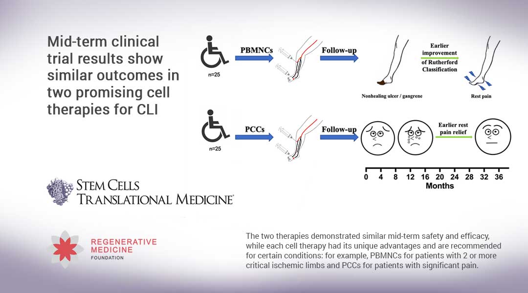 Mid-term clinical trial results show similar outcomes in two promising cell therapies for CLI