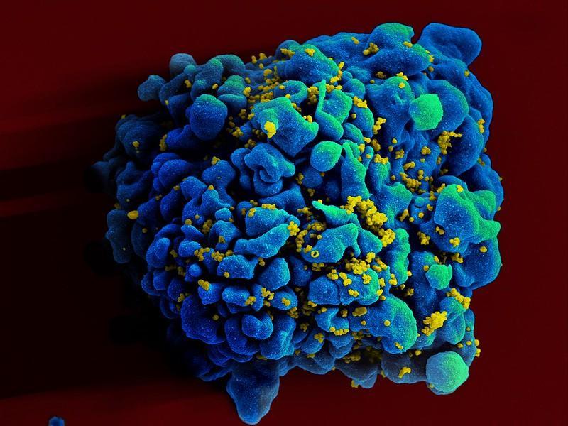 Experimental mRNA HIV Vaccine Safe, Shows Promise in Animals